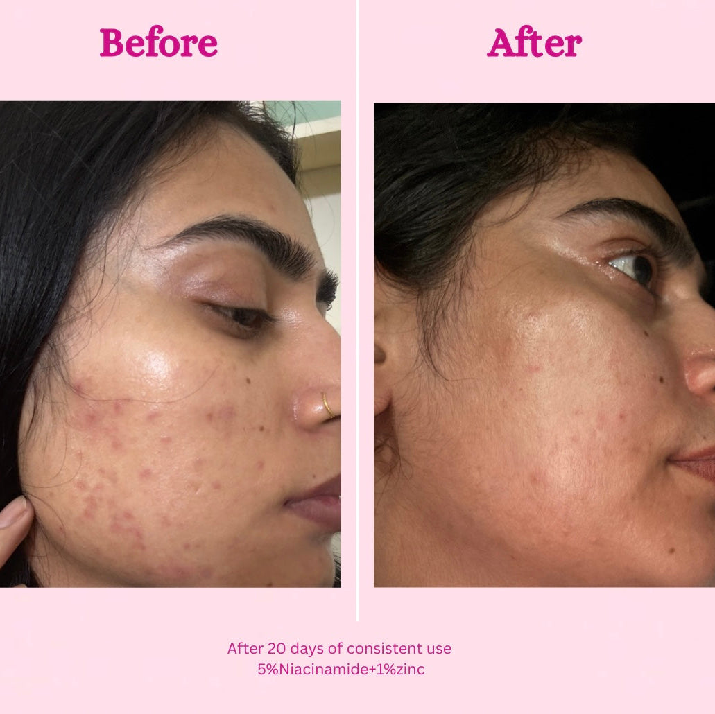 Niacinamide Serum